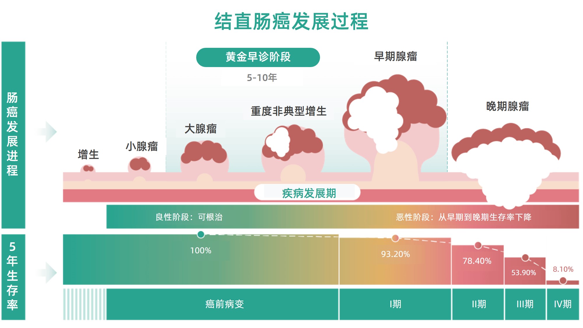 肠癌演变过程图.jpg